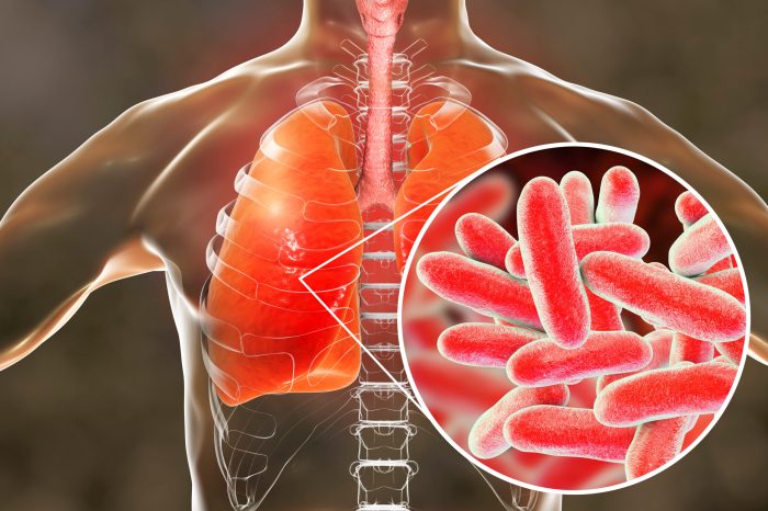 Legionella pneumophila disease lungs legionnaires bacteria conceptual illustration stock close pneumonia water found alamy legionnaire caused infection gram negative wellness